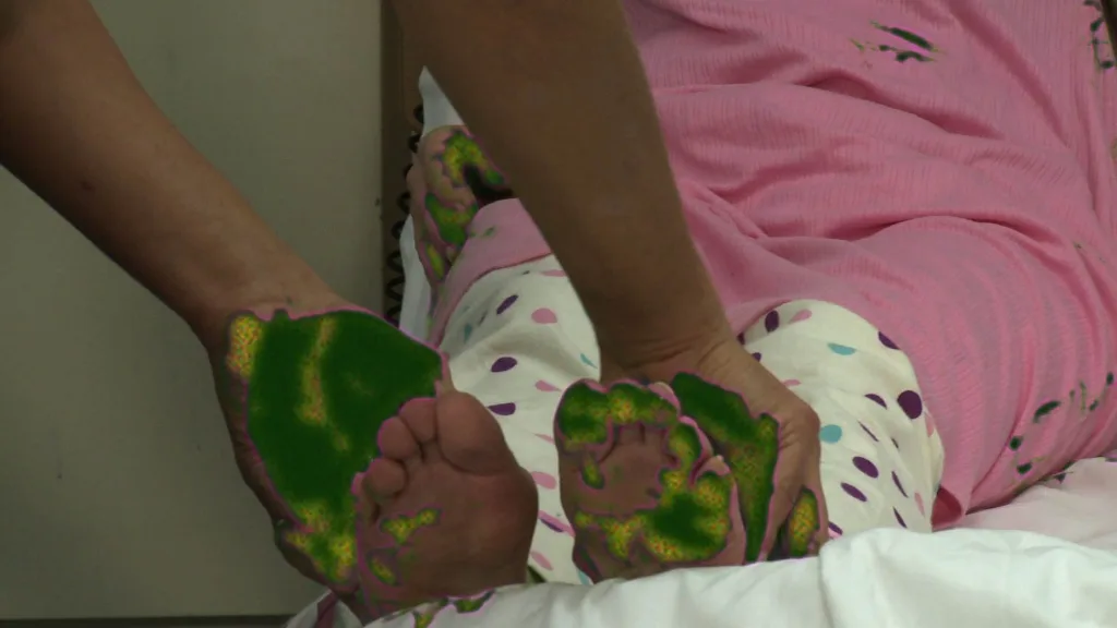 Infection Control - University Of Birmingham training film - Floating Harbour Bristol